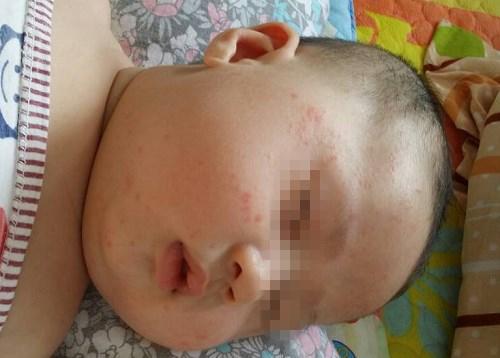 凯发K8一触即发养生十个小常识宝宝感冒宝宝低烧可以洗澡吗宝宝浑身瘙痒化脓发烧送医